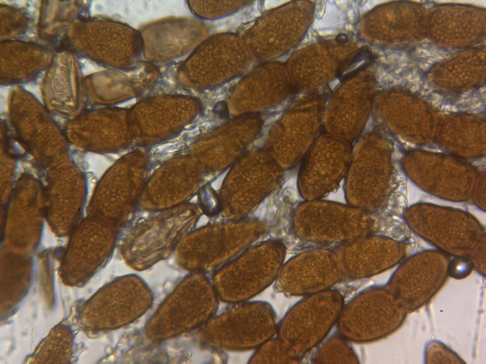 Microscopía de Puccinia buxi - 10 - Teliosporas agua